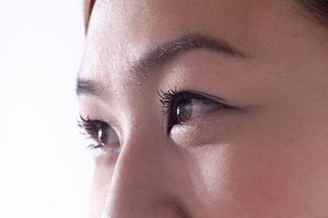 肥厚性瘢痕をレーザー治療で効果的に改善するための完全ガイド